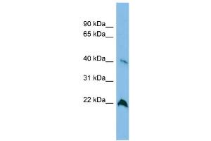 WB Suggested Anti-TGDS Antibody Titration: 0. (TGDS 抗体  (Middle Region))
