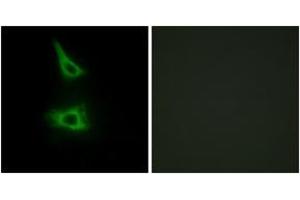 Immunofluorescence analysis of HeLa cells, using CDH17 Antibody. (LI Cadherin 抗体  (AA 341-390))