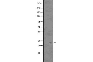 Western blot analysis of Rab9 using 293 whole cell lysates (RAB9A 抗体  (Internal Region))