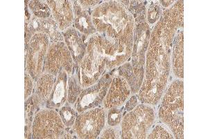 ABIN6267296 at 1/200 staining human kidney sections by IHC-P.