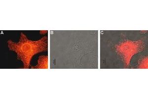 Expression of MC1R in human Malme-3M cells - Immunocytochemical staining of human paraformaldehyde fixed and permeabilized malignant melanoma cell lines (Malme-3M). (MC1 Receptor 抗体  (AA 217-232))