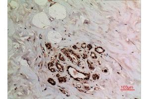 Immunohistochemistry (IHC) analysis of paraffin-embedded Human Breast, antibody was diluted at 1:100.