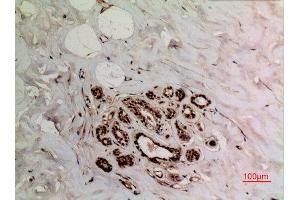 Immunohistochemistry (IHC) analysis of paraffin-embedded Human Breast, antibody was diluted at 1:100. (XRCC6 抗体  (acLys539))