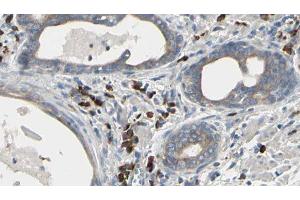 ABIN6277345 at 1/100 staining Human prostate tissue by IHC-P. (USO1 抗体  (C-Term))