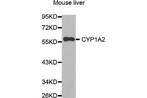 Western Blotting (WB) image for anti-Cytochrome P450, Family 1, Subfamily A, Polypeptide 2 (CYP1A2) (AA 205-305) antibody (ABIN6213604) (CYP1A2 抗体  (AA 205-305))