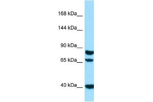 Western Blotting (WB) image for anti-Signal Peptide, CUB Domain, EGF-Like 1 (SCUBE1) (N-Term) antibody (ABIN2790193) (SCUBE1 抗体  (N-Term))