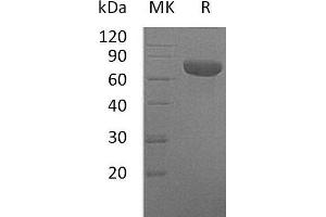 Western Blotting (WB) image for Cytokine Receptor-Like Factor 2 (CRLF2) protein (Fc Tag) (ABIN7320659) (CRLF2 Protein (Fc Tag))