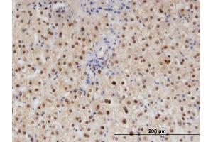 Immunostaining (ISt) image for anti-RAD23 Homolog B (RAD23B) (AA 311-409) antibody (ABIN519603)