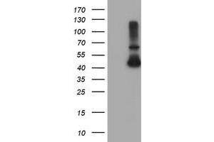 Western Blotting (WB) image for anti-Alcohol Dehydrogenase 7 (Class IV), mu Or sigma Polypeptide (ADH7) antibody (ABIN1496482) (ADH7 抗体)