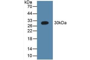 Detection of Recombinant C1qA, Human using Polyclonal Antibody to Complement Component 1, Q Subcomponent A (C1qA) (C1QA 抗体  (AA 28-245))