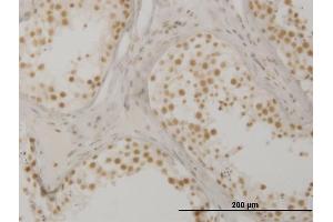 Immunoperoxidase of monoclonal antibody to OXSR1 on formalin-fixed paraffin-embedded human testis. (OXSR1 抗体  (AA 351-450))
