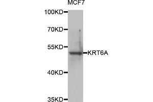 Western blot analysis of extracts of MCF-7 cells, using KRT6A antibody (ABIN5974635) at 1/1000 dilution. (KRT6A 抗体)