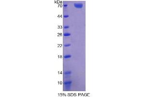 SDS-PAGE analysis of Human TFDP1 Protein. (DP1 蛋白)