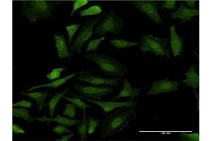 Immunofluorescence of monoclonal antibody to GAGE5 on HeLa cell. (G Antigen 5 抗体  (AA 28-117))