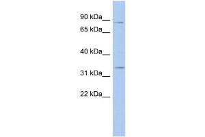 WB Suggested Anti-STX19 Antibody Titration: 0. (Syntaxin 19 抗体  (N-Term))