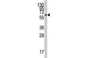 Western blot analysis of CYP26A1 antibody and Jurkat lysate (CYP26A1 抗体  (AA 118-147))