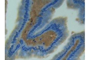 Immunohistochemistry (IHC) image for anti-Nitric Oxide Synthase 2, Inducible (NOS2) (AA 43-213) antibody (ABIN7432715)