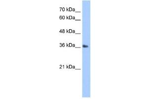 TIPIN antibody (20R-1275) used at 0. (TIPIN 抗体  (N-Term))