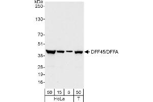 Western Blotting (WB) image for anti-DNA Fragmentation Factor, 45kDa, alpha Polypeptide (DFFA) (AA 271-331) antibody (ABIN7454749)