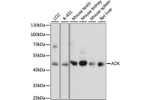 Western blot analysis of extracts of various cell lines, using ADK antibody  at 1:1000 dilution. (ADK 抗体  (AA 200-345))