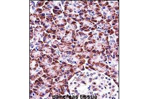 Immunohistochemistry (Paraffin-embedded Sections) (IHC (p)) image for anti-NLR Family, Pyrin Domain Containing 12 (NLRP12) (AA 183-212), (N-Term) antibody (ABIN657935)