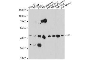 Western blot analysis of extracts of various cell lines, using HP antibody. (Haptoglobin 抗体)