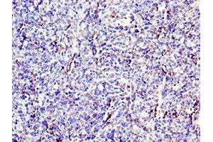 Immunohistochemistry of paraffin-embedded human thymus tissue using ABIN7171339 at dilution of 1:100 (CD6 抗体  (AA 424-668))