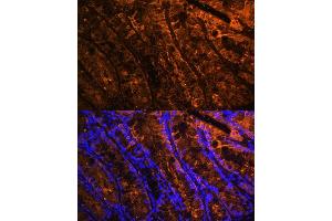 Immunofluorescence analysis of mouse colon using Galectin 4/LG Polyclonal Antibody (ABIN7267339) at dilution of 1:100 (40x lens). (GAL4 抗体  (AA 1-100))