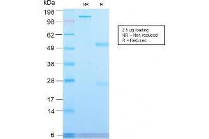 SDS-PAGE Analysis Purified CD71 Rabbit Recombinant Monoclonal Antibody (TFRC/2898R). (Recombinant Transferrin Receptor 抗体  (Extracellular Domain))