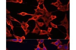 Immunofluorescence analysis of NIH/3T3 cells using TYMS Polyclonal Antibody at dilution of 1:100. (TYMS 抗体)