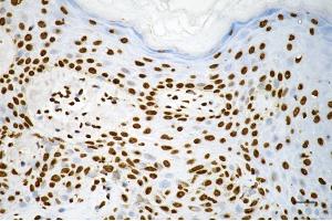 Immunohistochemistry was performed on paraffin-embedded human skin tissue using macroH2A. (Recombinant Histone, H2A1, Macro 抗体)