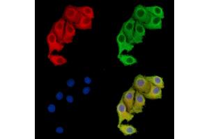 ABIN7096113 and ABIN7100175 staining Hela cells by IF/ICC. (WDR41 抗体)