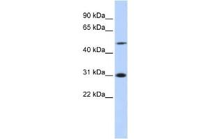 Western Blotting (WB) image for anti-Inhibitor of Growth Family, Member 3 (ING3) antibody (ABIN2458018) (ING3 抗体)