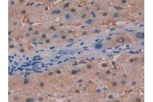 DAB staining on IHC-P; Samples: Human Liver Tissue (FAH 抗体  (AA 189-419))