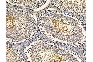 ABIN7094985 and ABIN7099041 at 1/100 staining rat testis tissue by IHC-P.