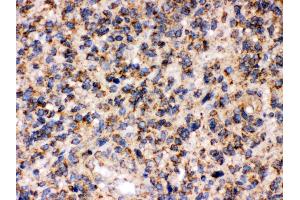 Immunohistochemistry (IHC) image for anti-Amyloid beta (A4) Precursor Protein-Binding, Family B, Member 1 (Fe65) (APBB1) (AA 21-56), (N-Term) antibody (ABIN3043784)