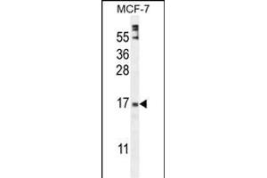 ZN Antibody (Center) (ABIN654974 and ABIN2844614) western blot analysis in MCF-7 cell line lysates (35 μg/lane). (ZNF720 抗体  (AA 34-62))