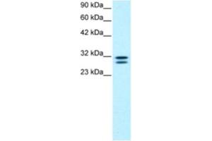Western Blotting (WB) image for anti-HIV-1 Tat Interactive Protein 2, 30kDa (HTATIP2) antibody (ABIN2460567) (HIV-1 Tat Interactive Protein 2, 30kDa (HTATIP2) 抗体)
