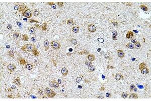 Immunohistochemistry of paraffin-embedded Mouse brain using CAST Polyclonal Antibody at dilution of 1:100 (40x lens). (Calpastatin 抗体)