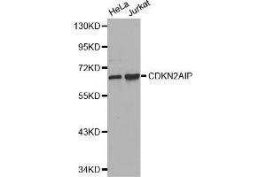 Western blot analysis of extracts of various cell lines, using CDKN2AIP antibody. (CDKN2AIP 抗体  (AA 1-220))