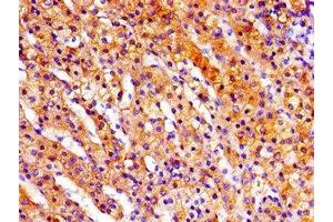 Immunohistochemistry (IHC) image for anti-Ribosomal Protein S6 Kinase, 90kDa, Polypeptide 3 (RPS6KA3) (AA 214-431) antibody (ABIN7168180)