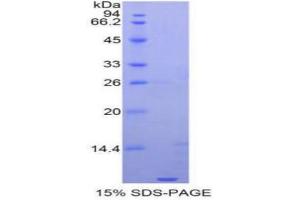 SDS-PAGE analysis of Human Apolipoprotein C1 Protein. (APOC1 蛋白)