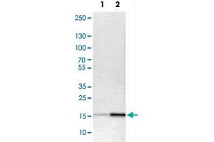 Western Blot analysis of Lane 1: NIH-3T3 cell lysate (mouse embryonic fibroblast cells) and Lane 2: NBT-II cell lysate (Wistar rat bladder tumour cells) with ACP1 polyclonal antibody . (ACP1 抗体)
