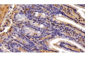 Detection of GHRL in Mouse Colon Tissue using Polyclonal Antibody to Ghrelin (GHRL)