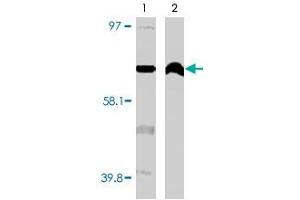 Western blot using CYP4F11 monoclonal antibody, clone F21 P6 F5  on normal (1) and cancerous (2) kidney cell lysates. (CYP4F11 抗体  (C-Term))
