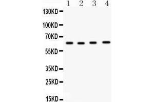 Western Blotting (WB) image for anti-Cell Division Cycle 6 Homolog (S. Cerevisiae) (CDC6) (AA 147-549) antibody (ABIN3043500) (CDC6 抗体  (AA 147-549))