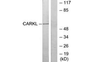 Western blot analysis of extracts from Jurkat cells, using CARKL Antibody. (SHPK 抗体  (AA 31-80))