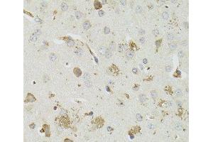 Immunohistochemistry of paraffin-embedded Mouse brain using PTPN3 Polyclonal Antibody at dilution of 1:100 (40x lens). (PTPN3 抗体)