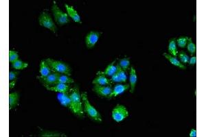 Immunofluorescent analysis of HepG2 cells using ABIN7165715 at dilution of 1:100 and Alexa Fluor 488-congugated AffiniPure Goat Anti-Rabbit IgG(H+L) (PKC zeta 抗体  (AA 494-575))