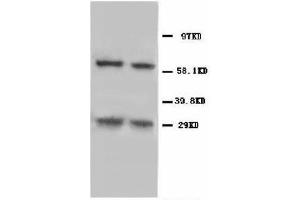 Image no. 1 for anti-BCL2/adenovirus E1B 19kDa Interacting Protein 3 (BNIP3) (N-Term) antibody (ABIN1493042) (BNIP3 抗体  (N-Term))